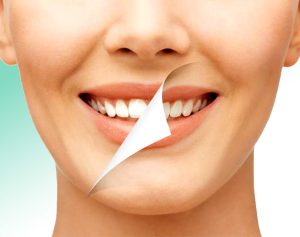 راه های سریع سفید کردن دندان